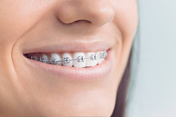 Best Dental Fillings (Composite and Amalgam)  in Halsey, OR